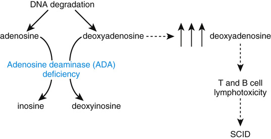 adenosine deaminase scid