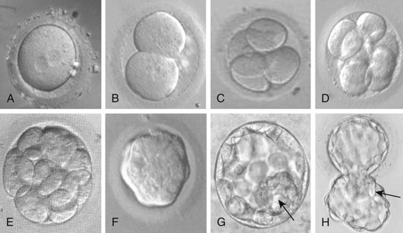 human embryo development day by day