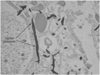 MICROBIOLOGY IN PATHOLOGY | Basicmedical Key