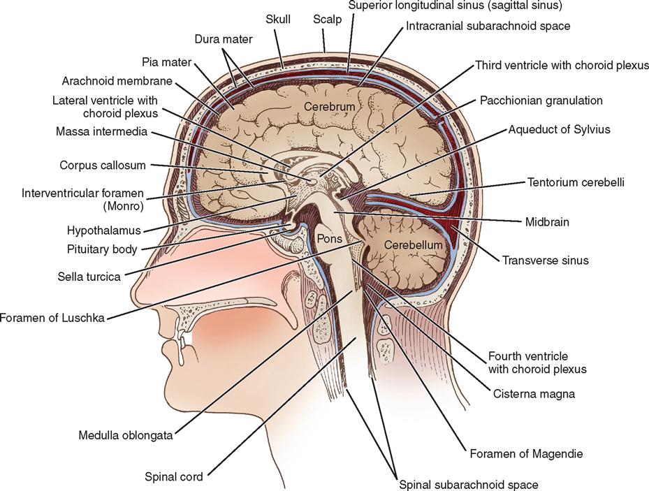 swelling of membrane of thebrain