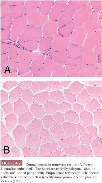 hypertrophy muscle microscope