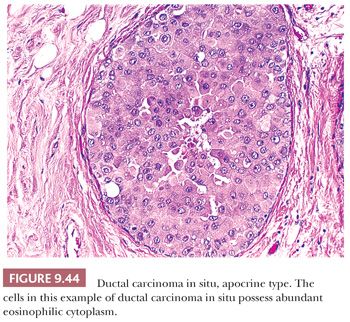 Breast | Basicmedical Key