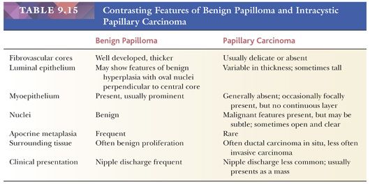 papilloma vs dcis