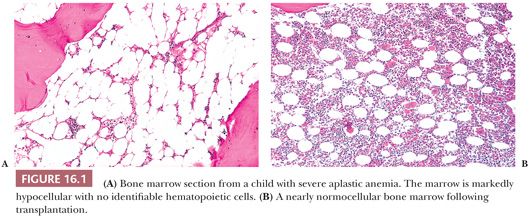 Bone Marrow | Basicmedical Key