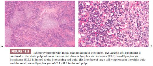 spleen histology