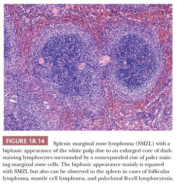 spleen histology