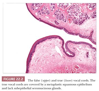 false vocal cords histology