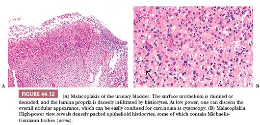 lamina propria bladder