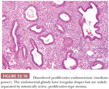 Result biopsy proliferative endometrium Cancer: Uterine