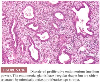 The pathology endometrium of Pathology Outlines