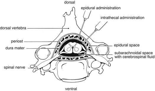 A315000_1_En_13_Fig2_HTML.gif