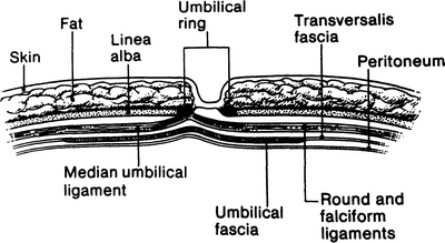 Abdominal Wall and Hernias | Basicmedical Key umbilicus diagram 