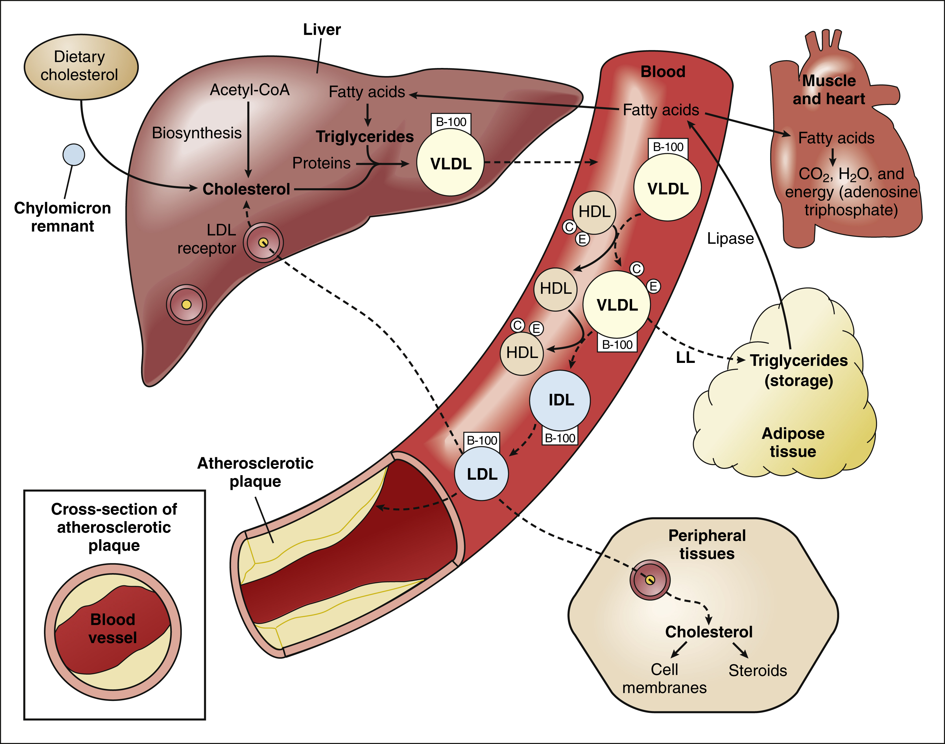 drugs-for-hyperlipidemia-basicmedical-key