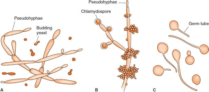 Opportunistic Mycoses | Basicmedical Key