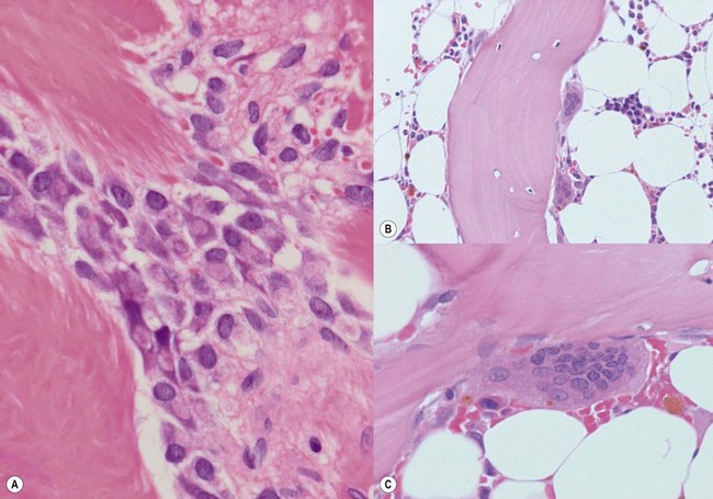 Normal Bone Marrow Histology | Basicmedical Key