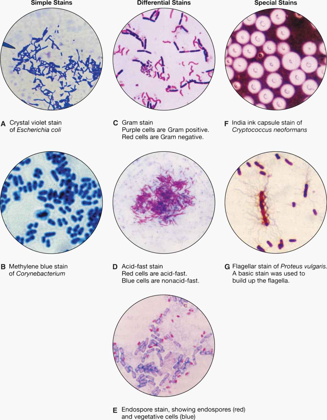 Gram Stain Results Interpretation Solved Part I Gram Stain Results