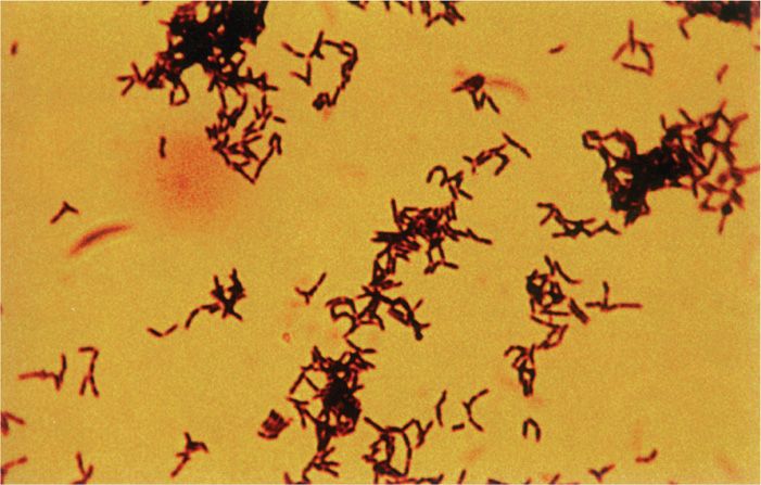 28 Actinomyces And Nocardia Basicmedical Key 