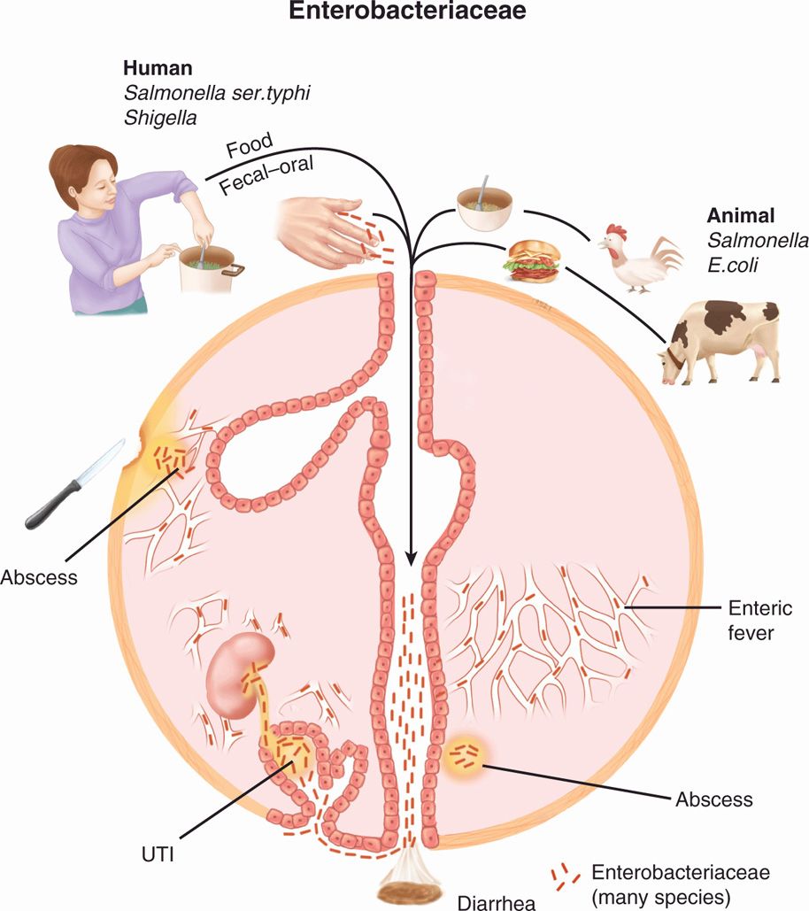 Эшерихиоз сальмонеллез. Эпидемиология Salmonella typhi. Salmonella typhi патогенез. Эшерихиоз эпидемиология. Брюшной тиф патогенез схема.