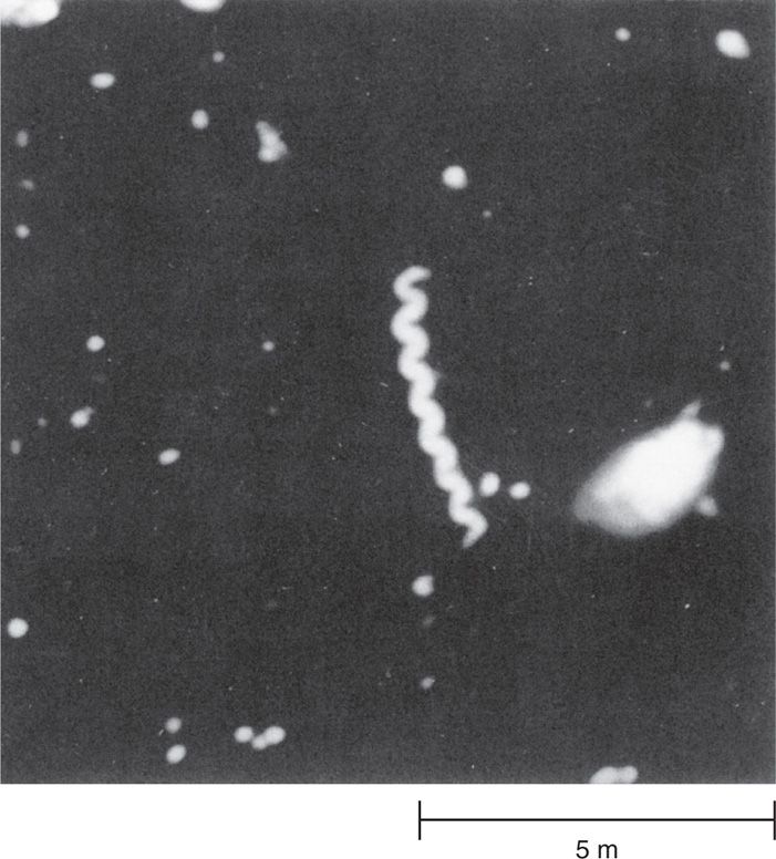 Spirochetes Gram Stain 9883