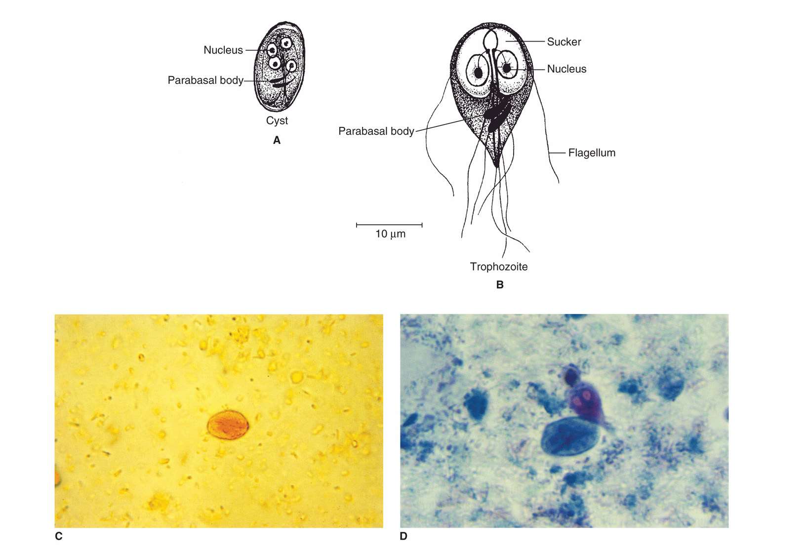 trichomonas vaginalis cyst