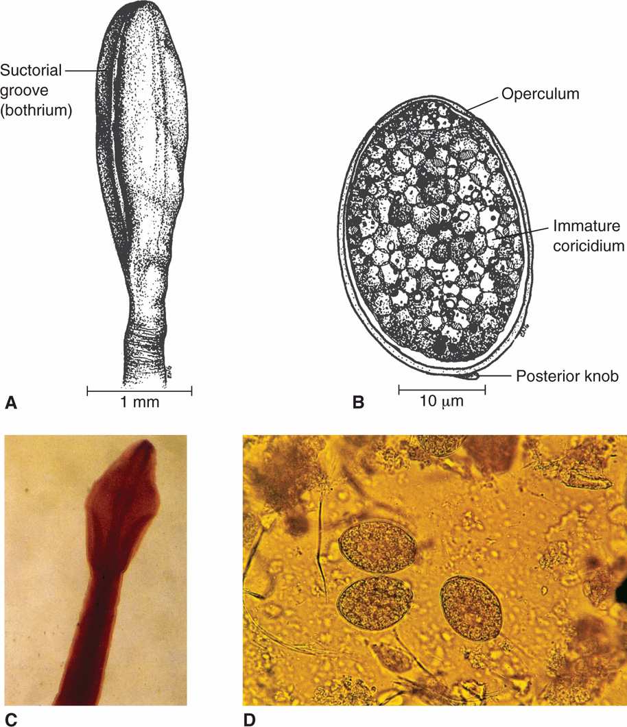 tapeworm diagram strobila