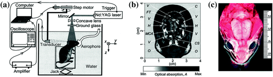 A305812_1_En_29_Fig6_HTML.gif