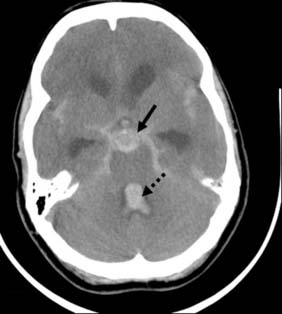 Neurosurgery | Basicmedical Key