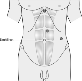 Spleen | Basicmedical Key