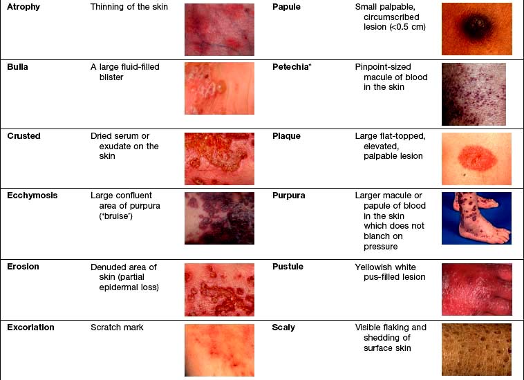 Skin Disease Basicmedical Key