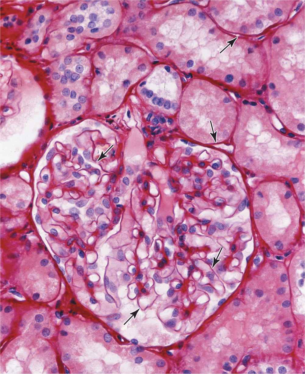 epithelial-tissue-basicmedical-key