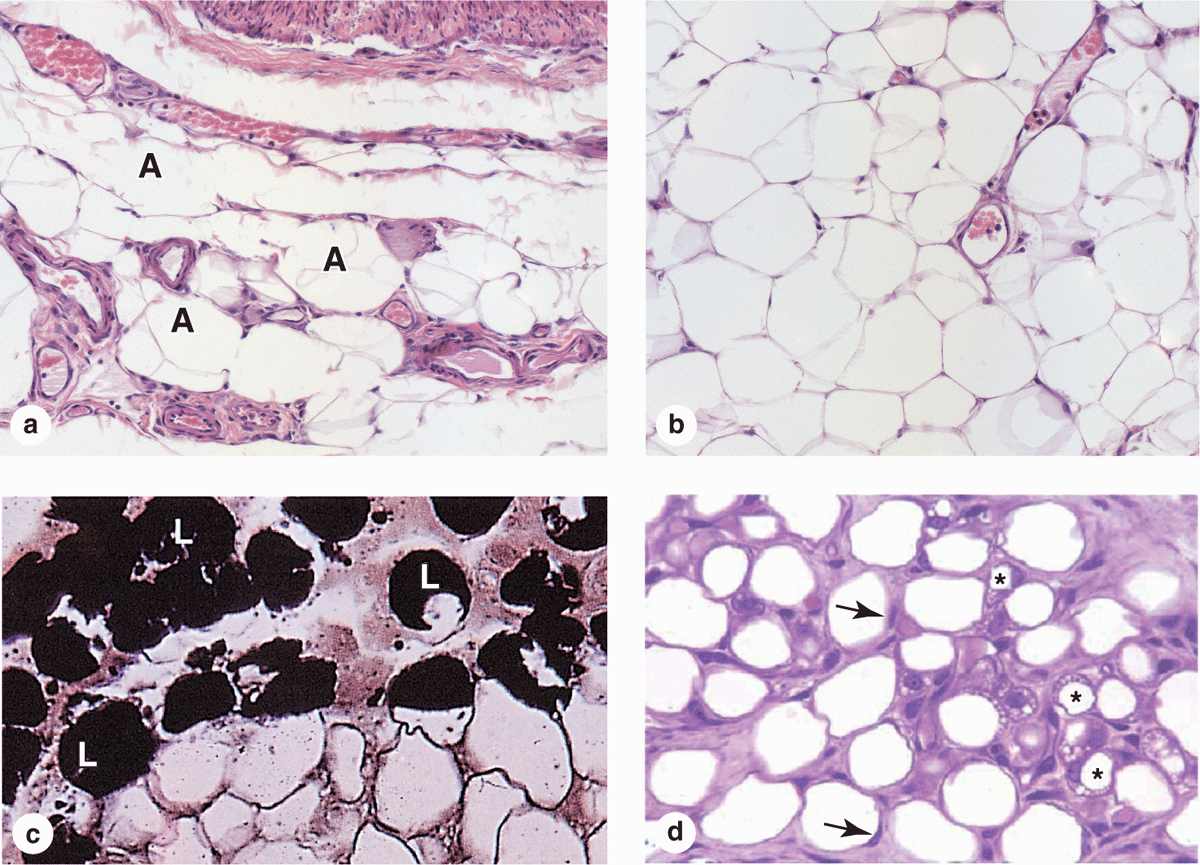 Adipose Connective Tissue Labeled