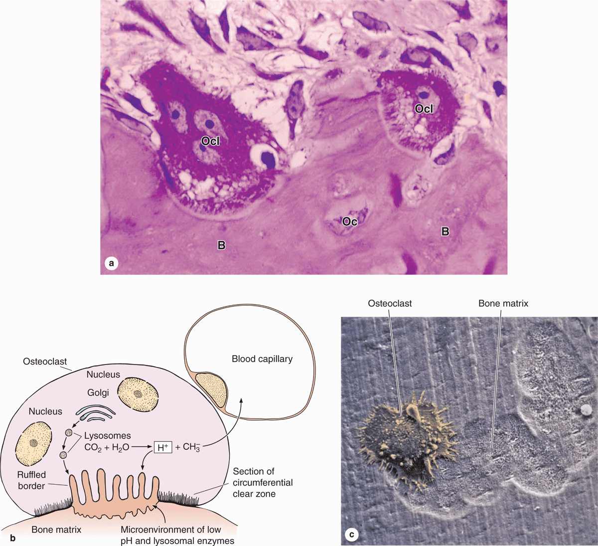 Osteoclasts Histology