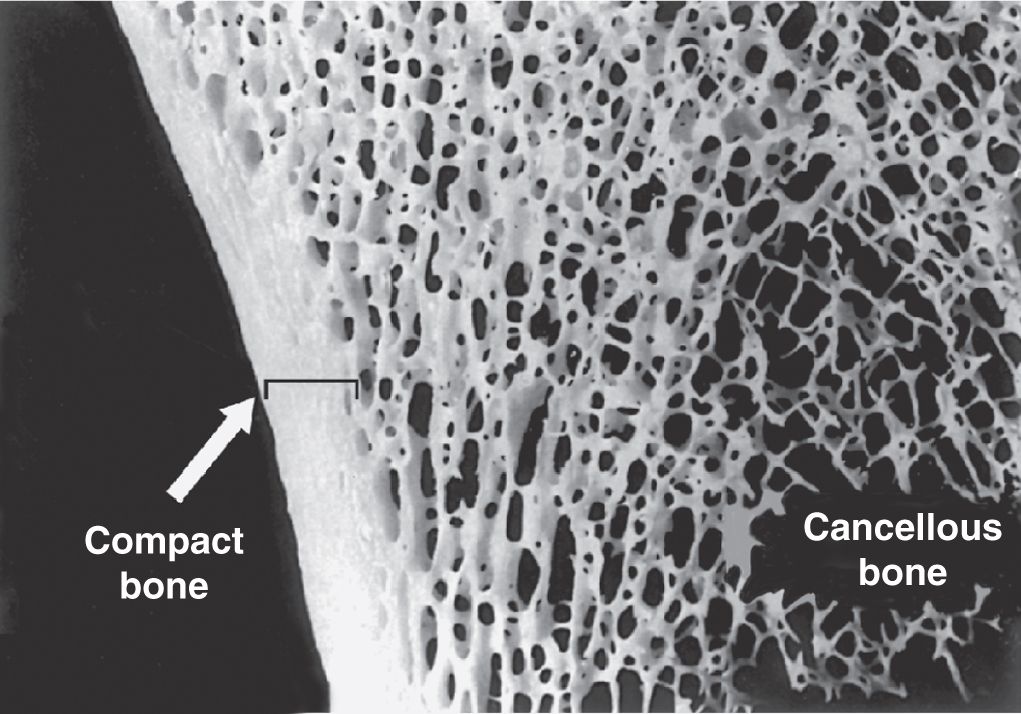 Bone | Basicmedical Key