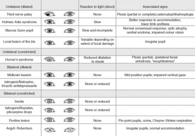 eye pupil size chart