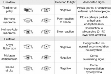 fixed dilated pupil differential diagnosis
