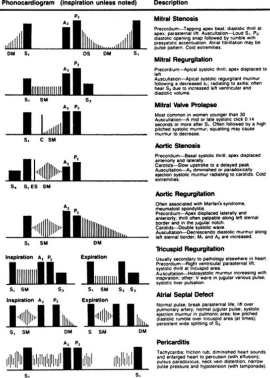 heart-murmurs-basicmedical-key