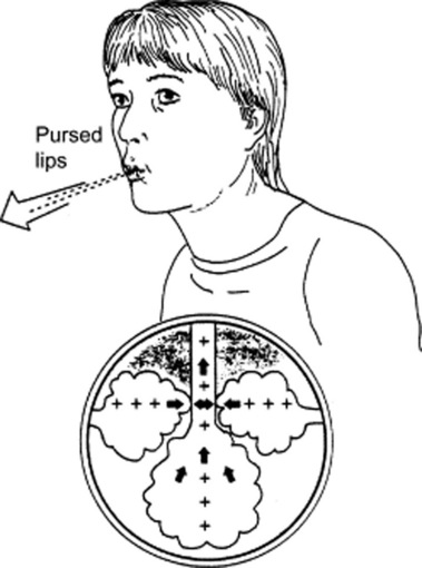 Breathing Labs – Efficacy of Pursed-Lips Breathing