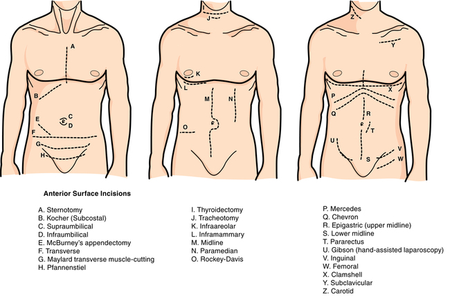 abdominal surgical incisions