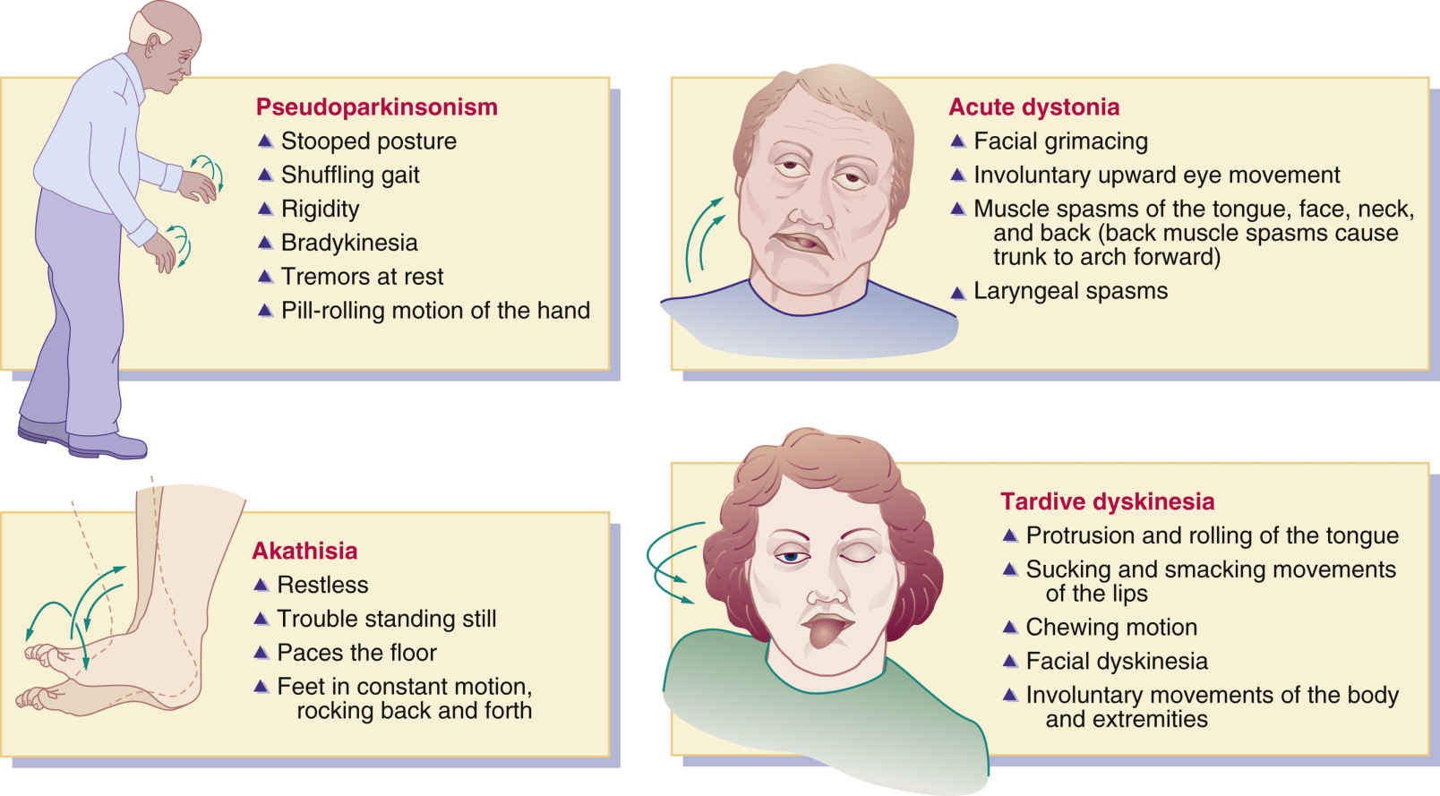 Acute Dystonia