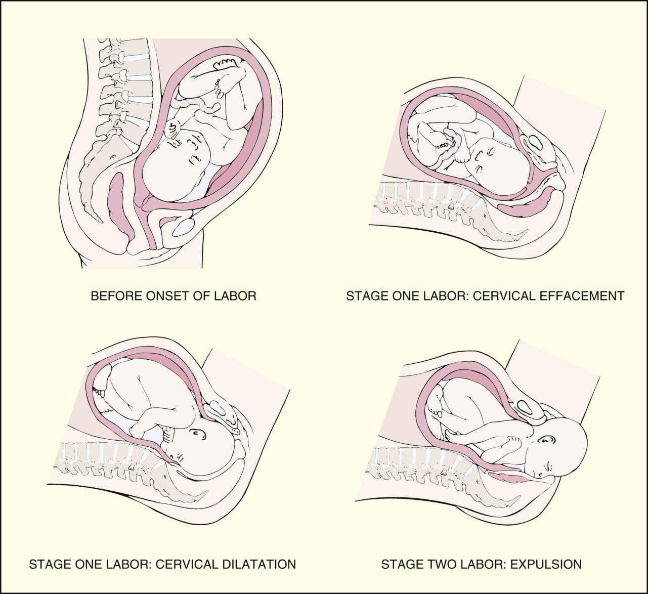 Stages of labor and delivery