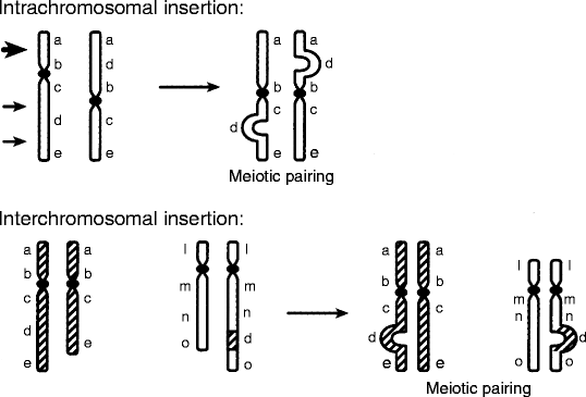 Structural Chromosome Rearrangements | Basicmedical Key