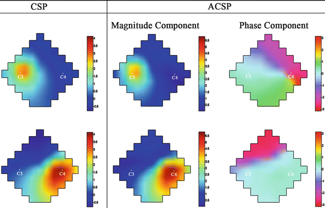 Variants Of The Common Spatial Patterns Method | Basicmedical Key