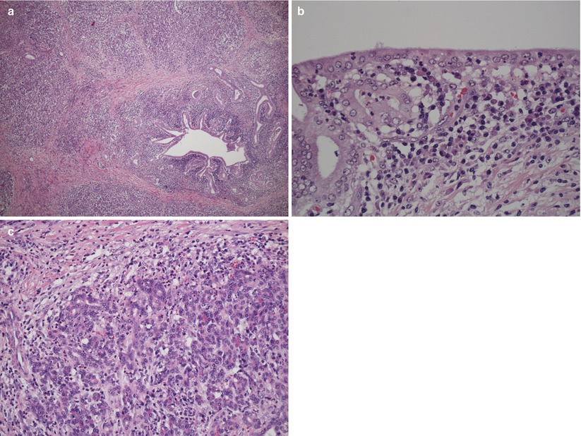 Pathology | Basicmedical Key