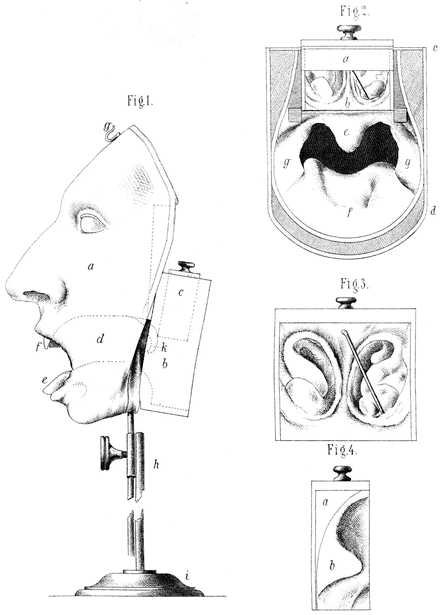 Simulation In Oto-, Rhino-, And Laryngology | Basicmedical Key