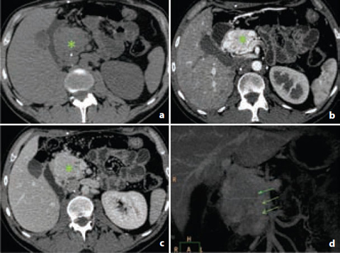 Imaging | Basicmedical Key