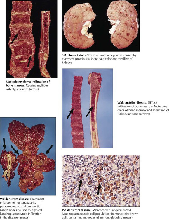 Hematopoietic And Lymphatic Tissues | Basicmedical Key