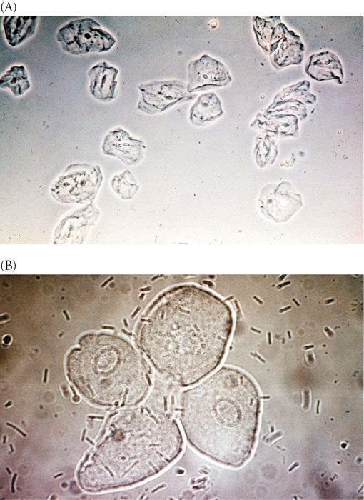 Urinalysis | Basicmedical Key