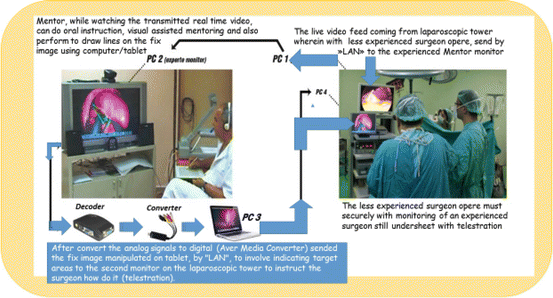 Teletraining In Minimal Access Surgery | Basicmedical Key