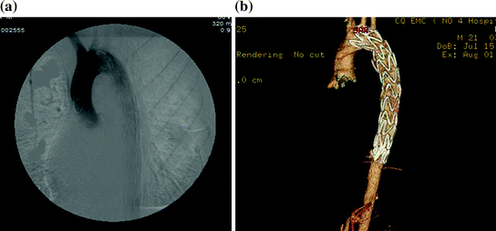 In The Management Of Thoracic Trauma | Basicmedical Key