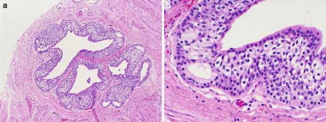 Normal Vulva: Embryology, Anatomy, And Histology | Basicmedical Key